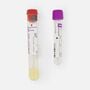 Kihealth Diabetes Risk Test - Earliest Detection Test for Diabetes, , large image number 2