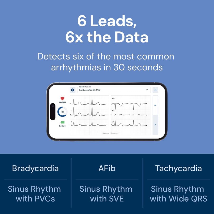 KardiaMobile 6L Max 6-Lead Personal EKG with 1-Year KardiaCare Subscription, , large image number 2