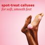 ONYX Professional&reg; Smooth It Off Callus Patches, 8 pc., , large image number 5