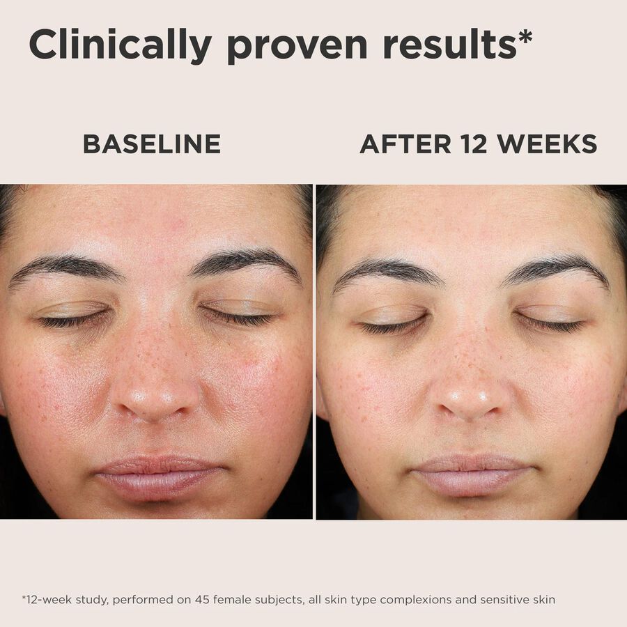 EltaMD UV Skin Recovery Broad Spectrum SPF 50 Face Sunscreen, , large image number 3