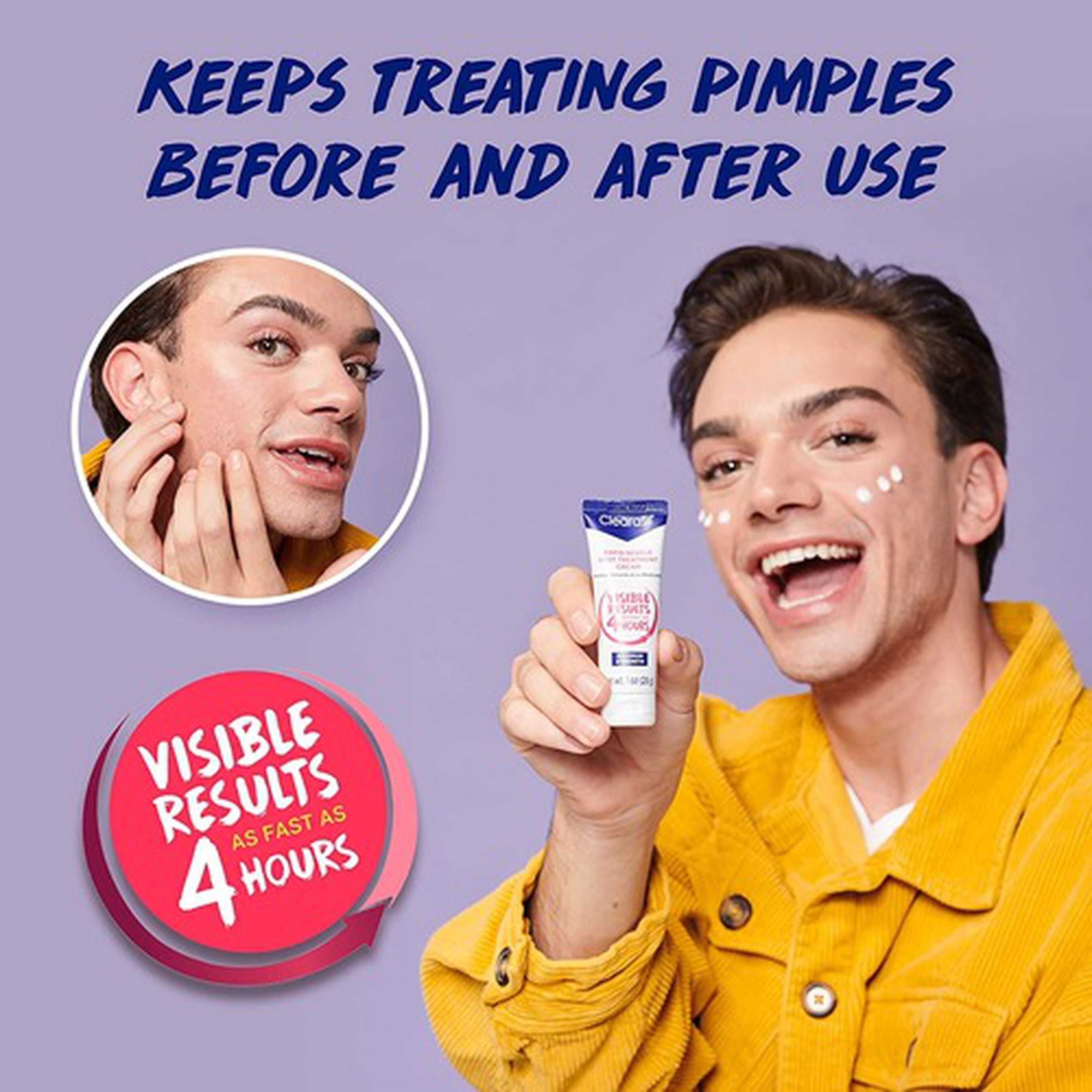 clearasil spot cream