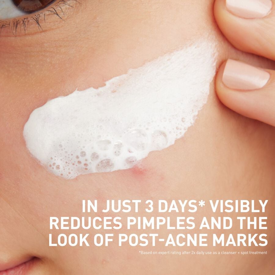 CeraVe&reg; Acne Clay to Foam Cleanser, , large image number 5