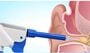 WaxRx Deluxe Ear Wash System, , large image number 1