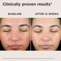 EltaMD UV Skin Recovery Red Color Correcting Green Tint Broad Spectrum SPF 50, , large image number 4