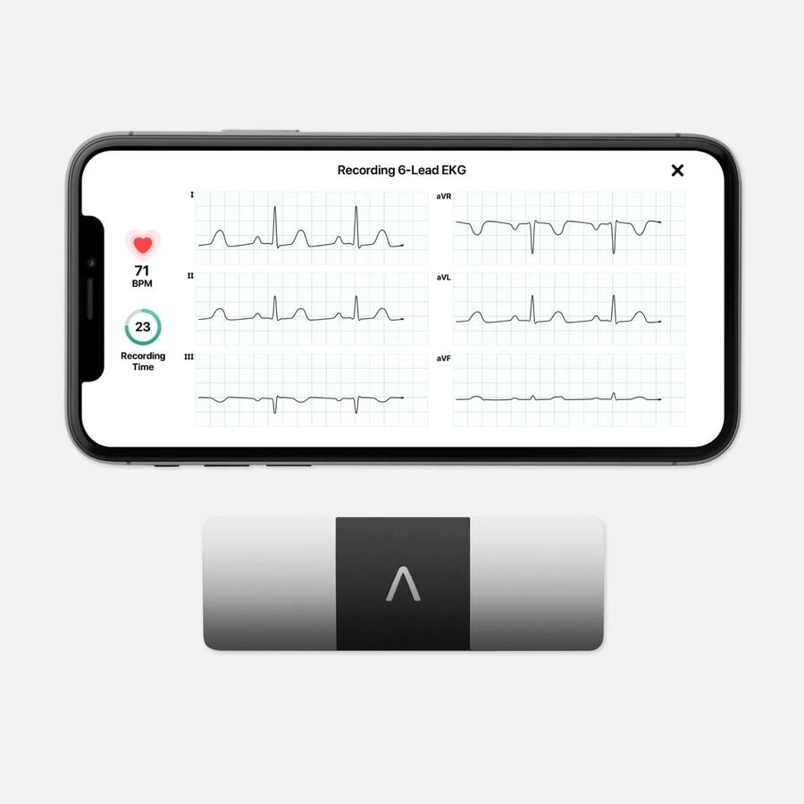 AliveCor KardiaMobile Personal EKG 6L, , large image number 0